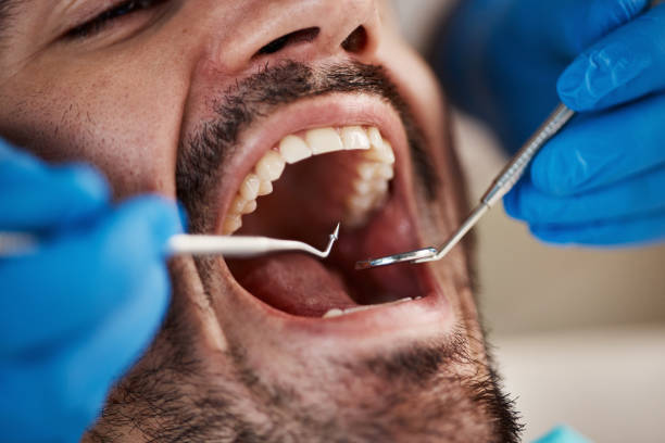 Best Emergency Gum Treatment in Aumsville, OR